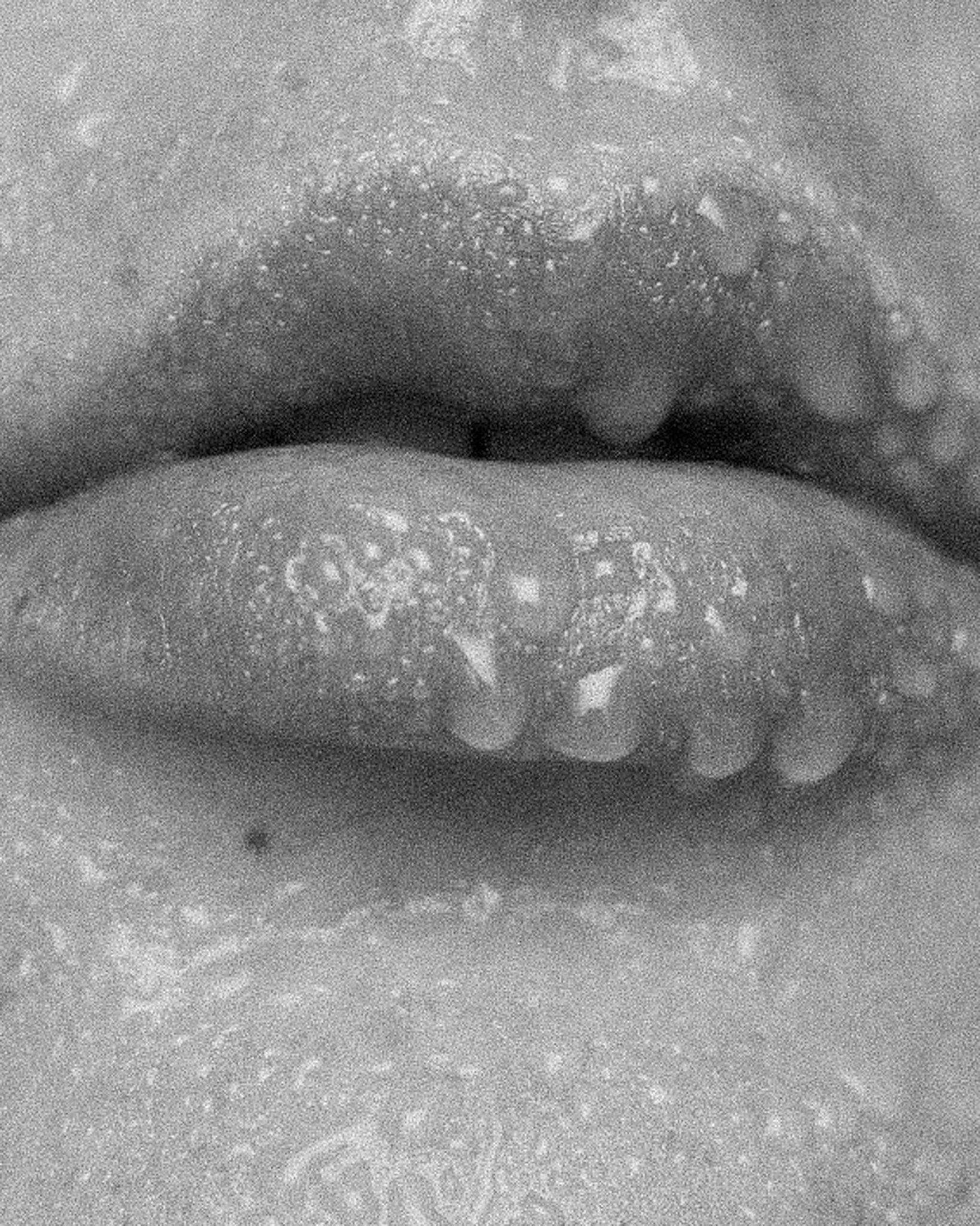 BW close up of lips with water drops